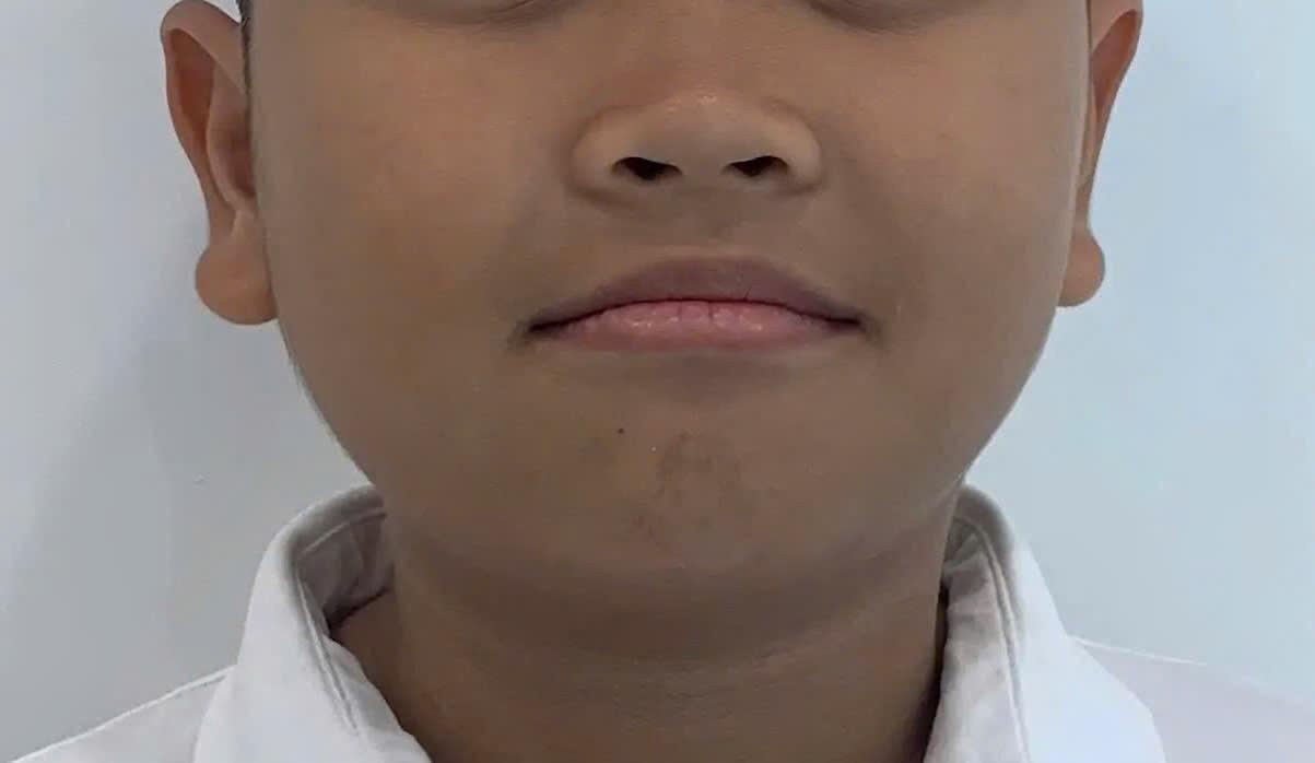 Zalo