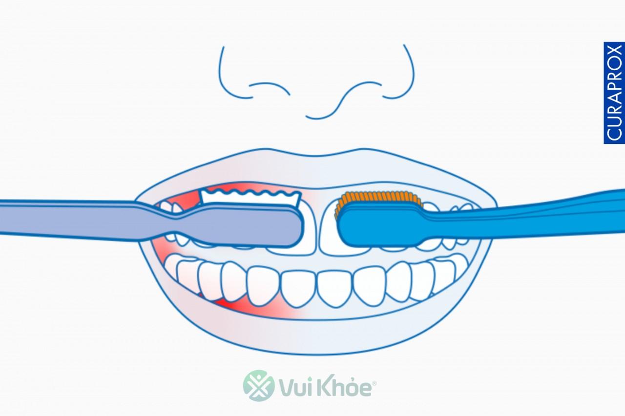 Bàn chải cứng vs bàn chải mềm