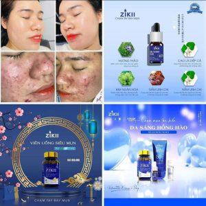Ai Nên Cẩn Trọng Khi Sử Dụng Serum Mụn ZIKII?