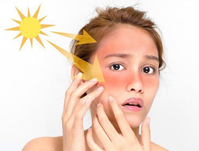 Ánh nắng mặt trời gây hại cho da rất lớn
