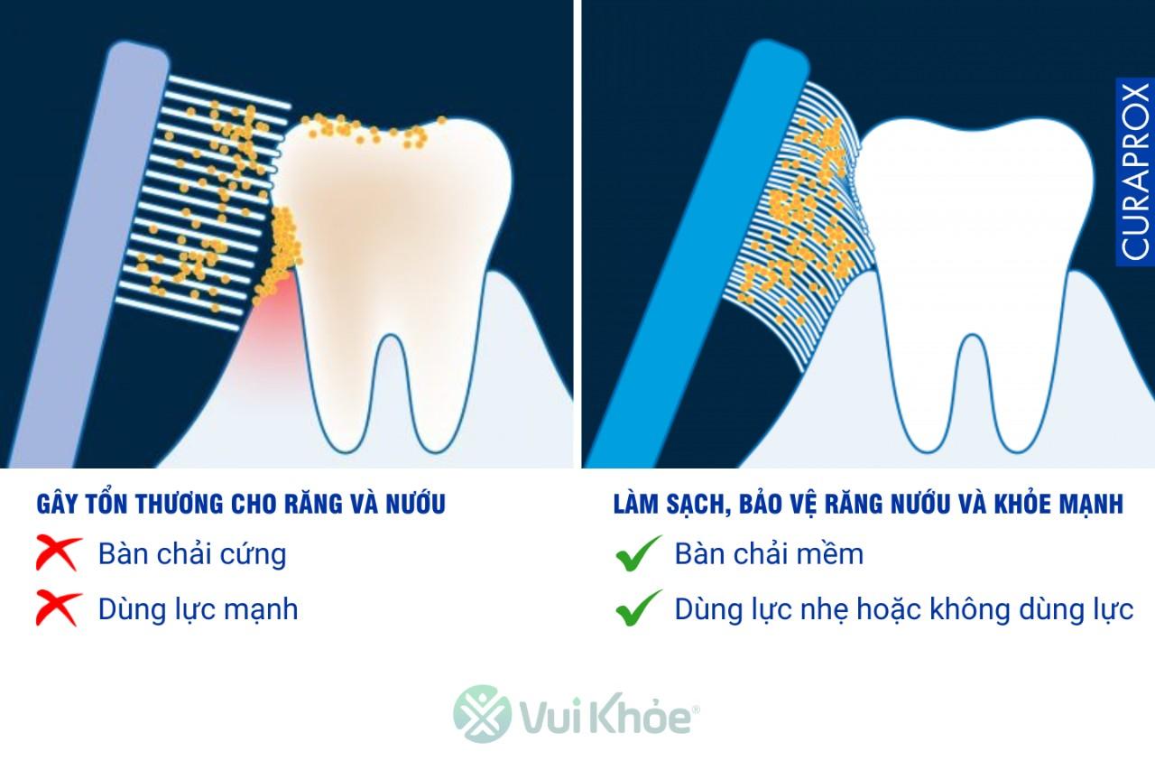 So sánh bàn chải lông cứng và lông mềm